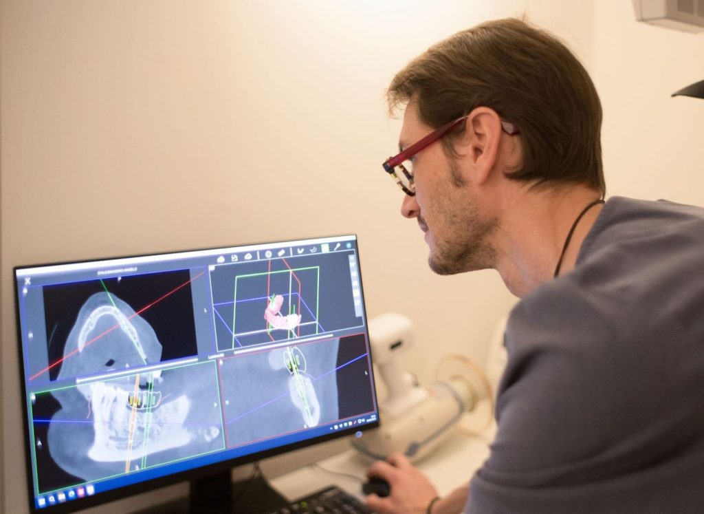 Impianto dentale: guida completa per capire come funziona 1 Impianto dentale